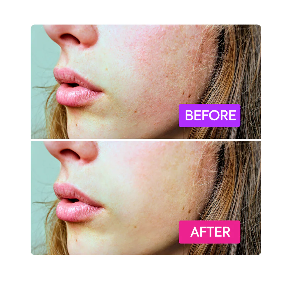 PROBIOTICS BOOSTER - IYKYK